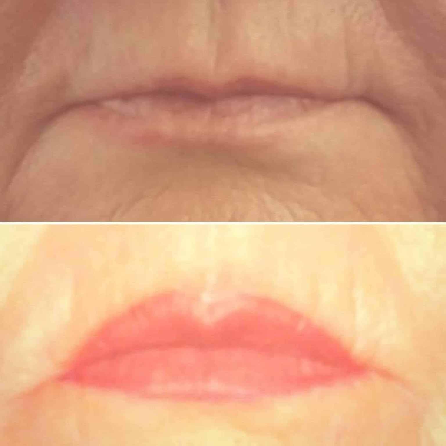 Comparativa de labios antes y después de micropigmentación